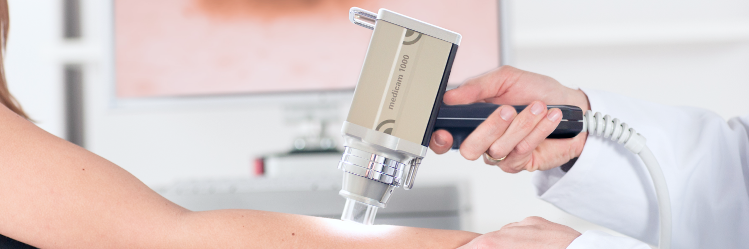 Цифровая дерматоскопия и картирование кожи на аппарате FotoFinder теперь в нашей клинике!
