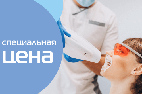 Отбеливание зубов BELLE по специальной стоимости - 23000₽!