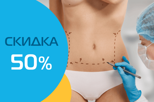 Бесплатная консультация и скидка 50% на абдоминопластику