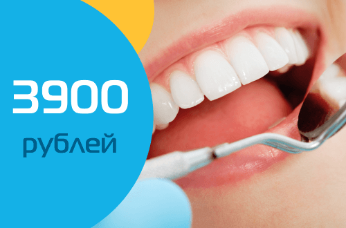 Профессиональная гигиена полости рта за 3 900 рублей!