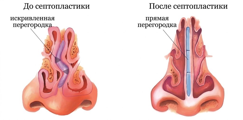 kty3j2kty3j2kty3.jpg